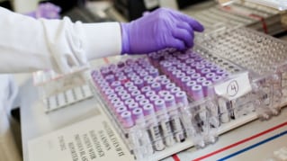 Tendances façonnant les stratégies des acteurs pharmaceutiques suisses